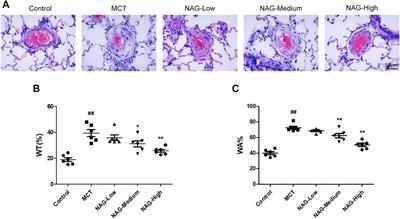 Naringin Ameliorates Monocrotaline-Induced Pulmonary Arterial Hypertension Through Endothelial-To-Mesenchymal Transition Inhibition